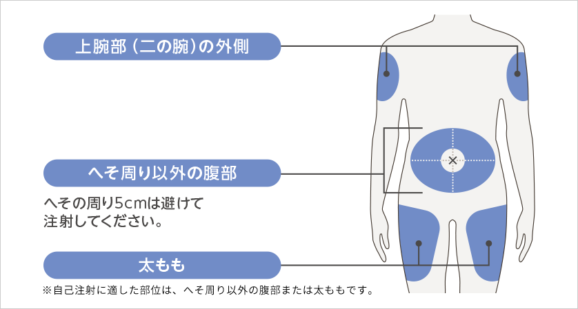 投与に適した場所